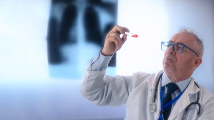 Why Experts Recommend Seniors Stop Routine Blood Tests After 80 — The Surprising New Guidelines